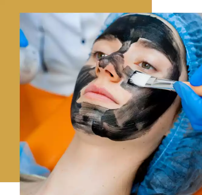 Carbon and Chemical Peel in Dubai