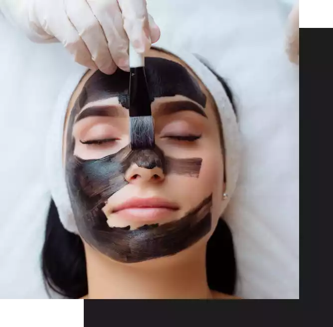 Carbon and Chemical Peel in Dubai