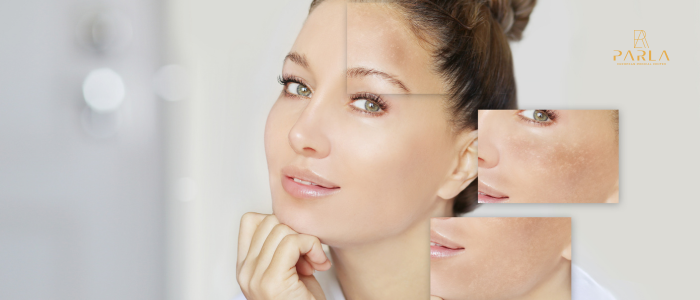 Skin Lightening Treatments in the UAE